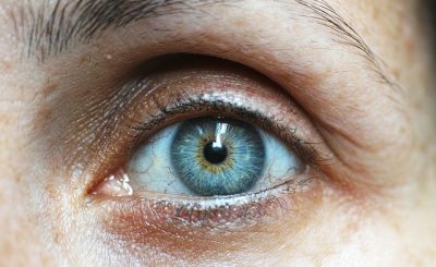 Derrame ocular, sus causas y efectos